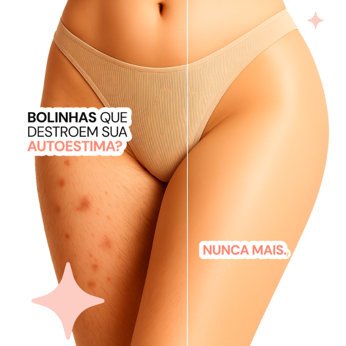 1 Depilador Elétrico Anti Foliculite
